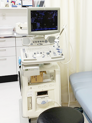 腹部超音波診断装置の画像